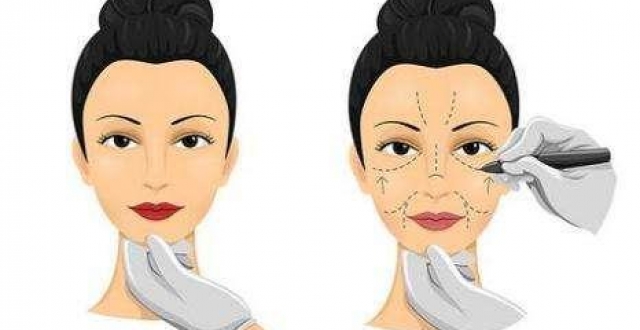 微整形软件合集